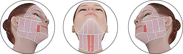 Facial treatmentの施術可能範囲